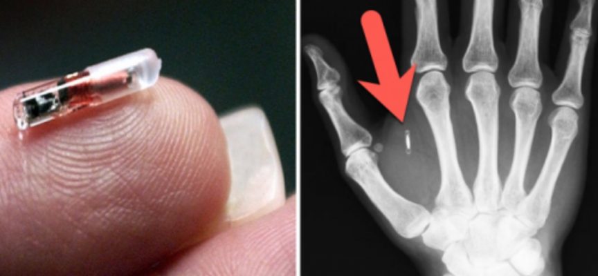 Greyerz – Implantable Human Microchips And The Great Reset